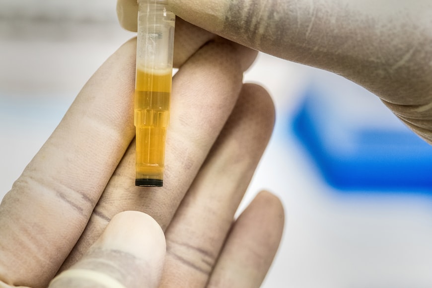 10 Panel Drug Test: 5 Important Facts ￼ 