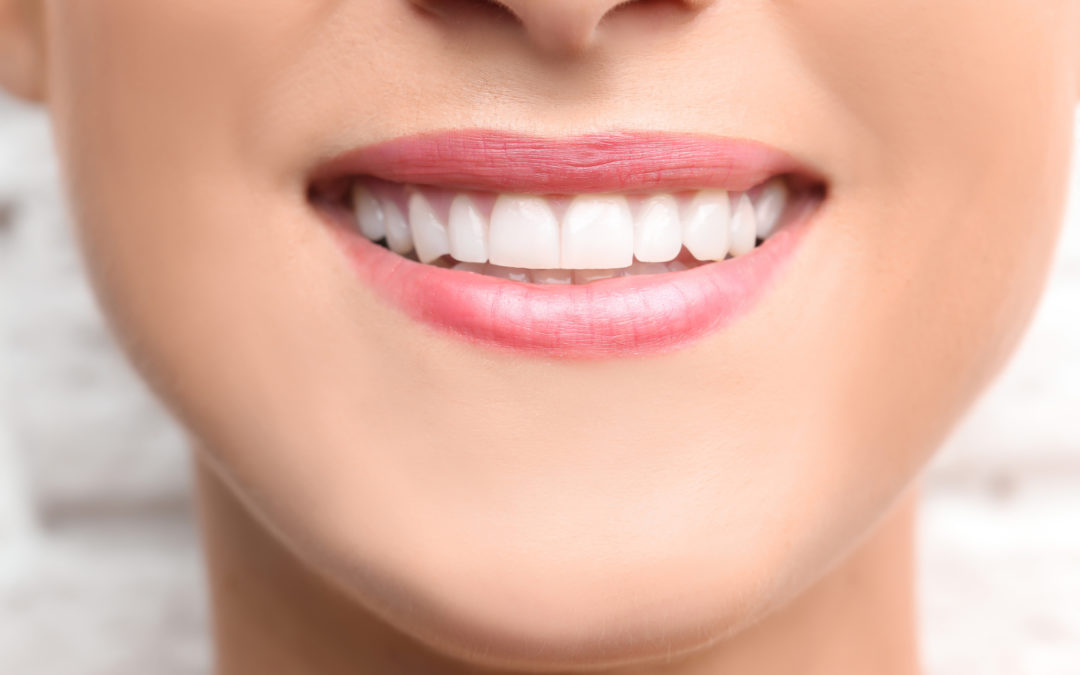 Dental Bonding- How Teeth Boding Helps in Your Dental Care?