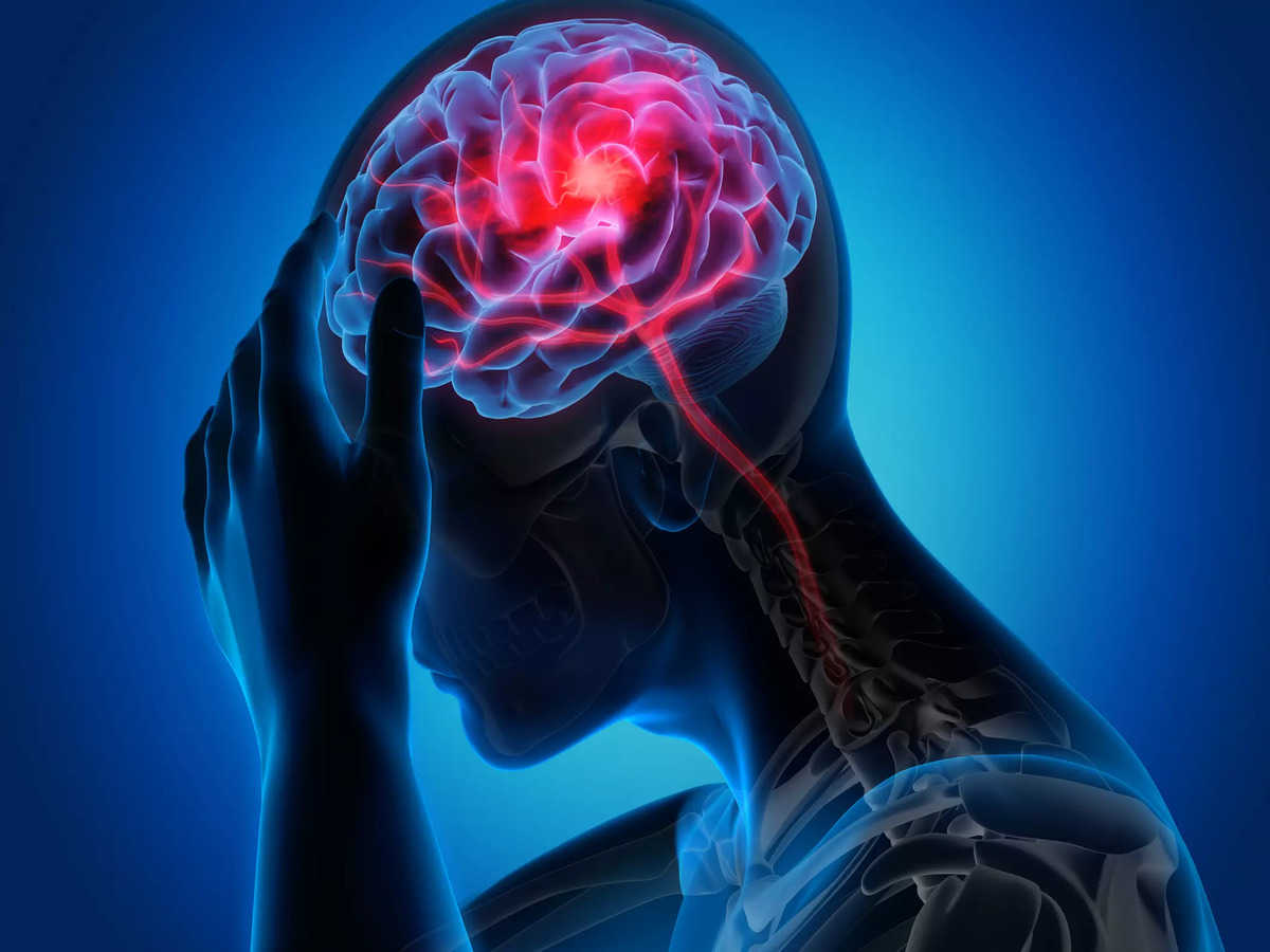 Having a Brain Stroke: Signs and Symptoms of Stroke