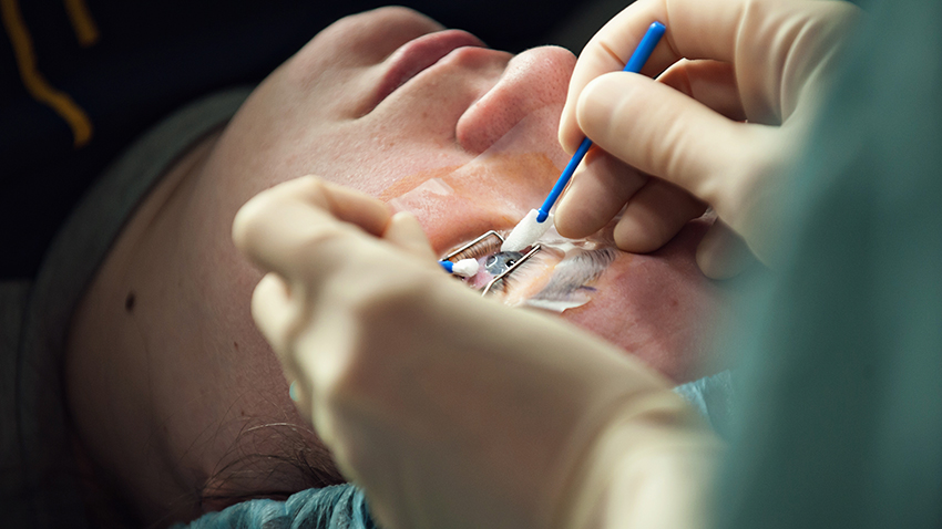 Is LASIK Surgery A Permanent Solution To Improve Vision?
